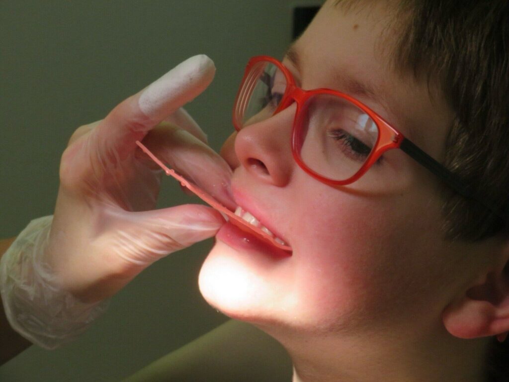 Top 4 Myths About Children's Dental Braces Debunked
