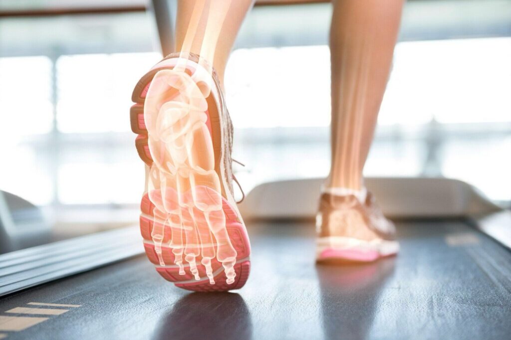 When to Seek Professional Help for Heel Pain After Running