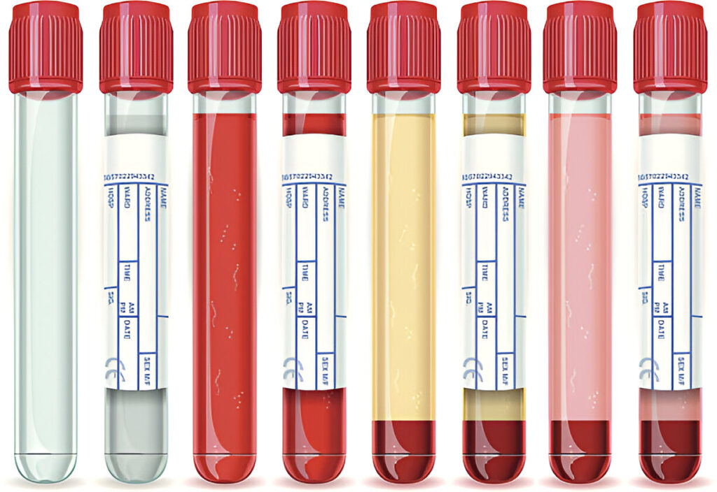 The Health Benefits and Practical Uses of Doob Tubes