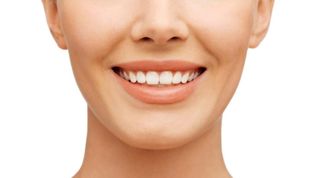 Teeth Whitening Services