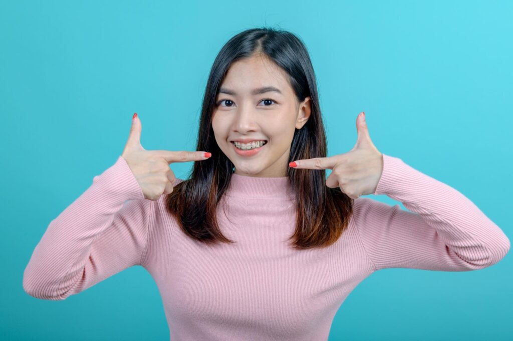 Top 4 Benefits of Choosing Aesthetic Braces Over Traditional Options