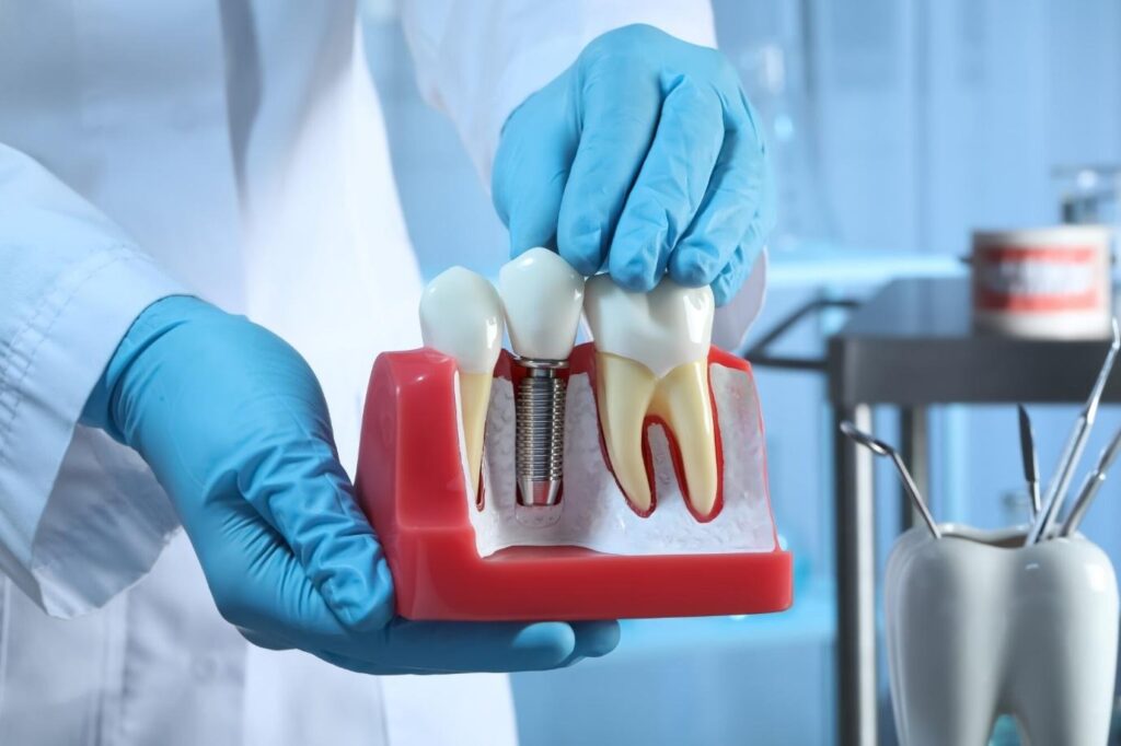 Top Tooth Replacement Options for a Healthy, Confident Smile Tooth Replacement