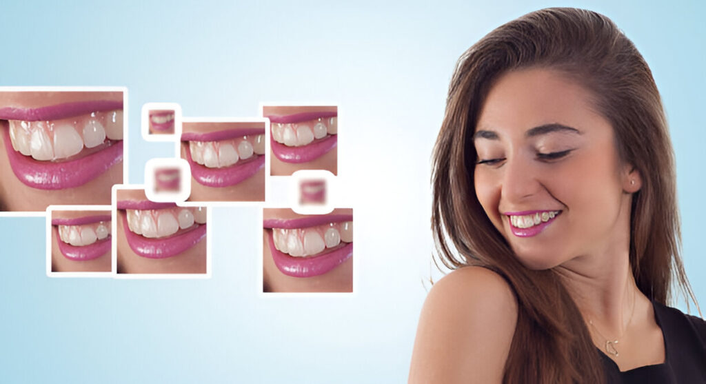 Beautiful Smile