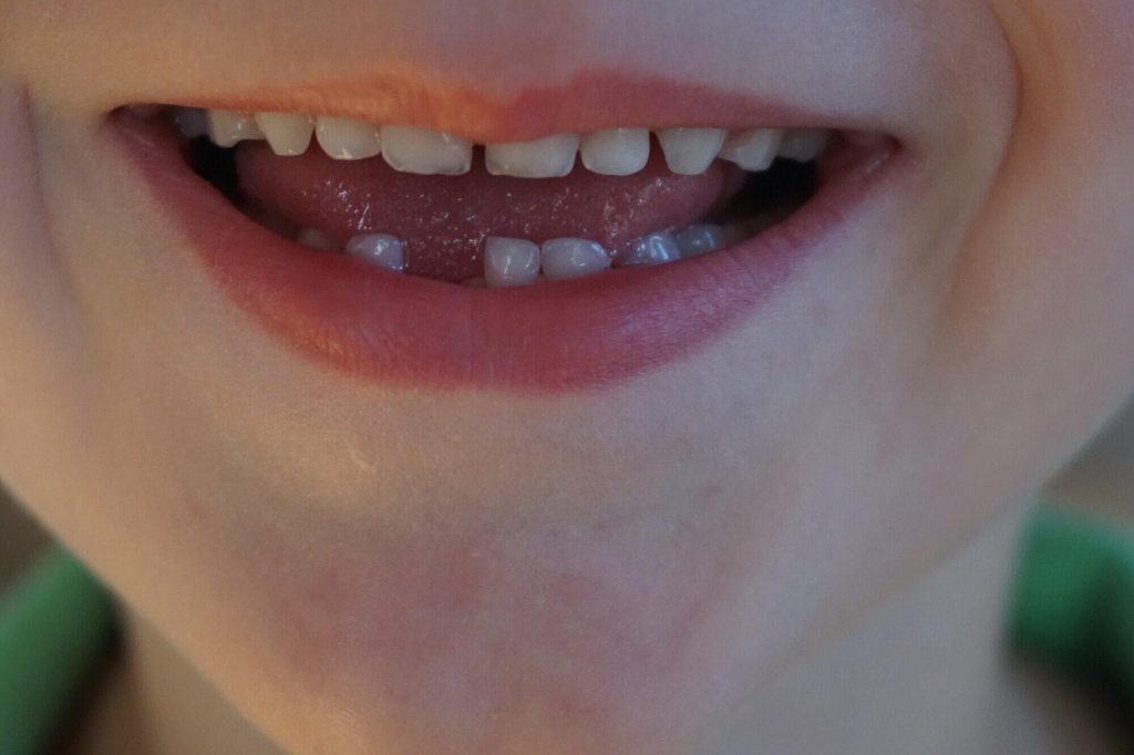 First Tooth Fairy