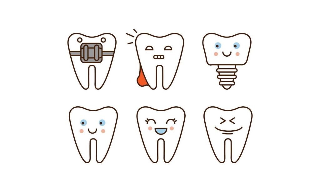 Understanding Dental Implants