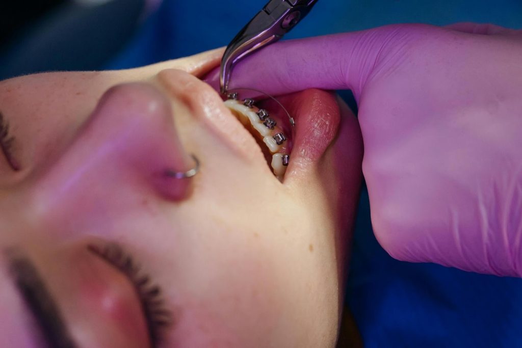 Orthodontic Treatment for You
