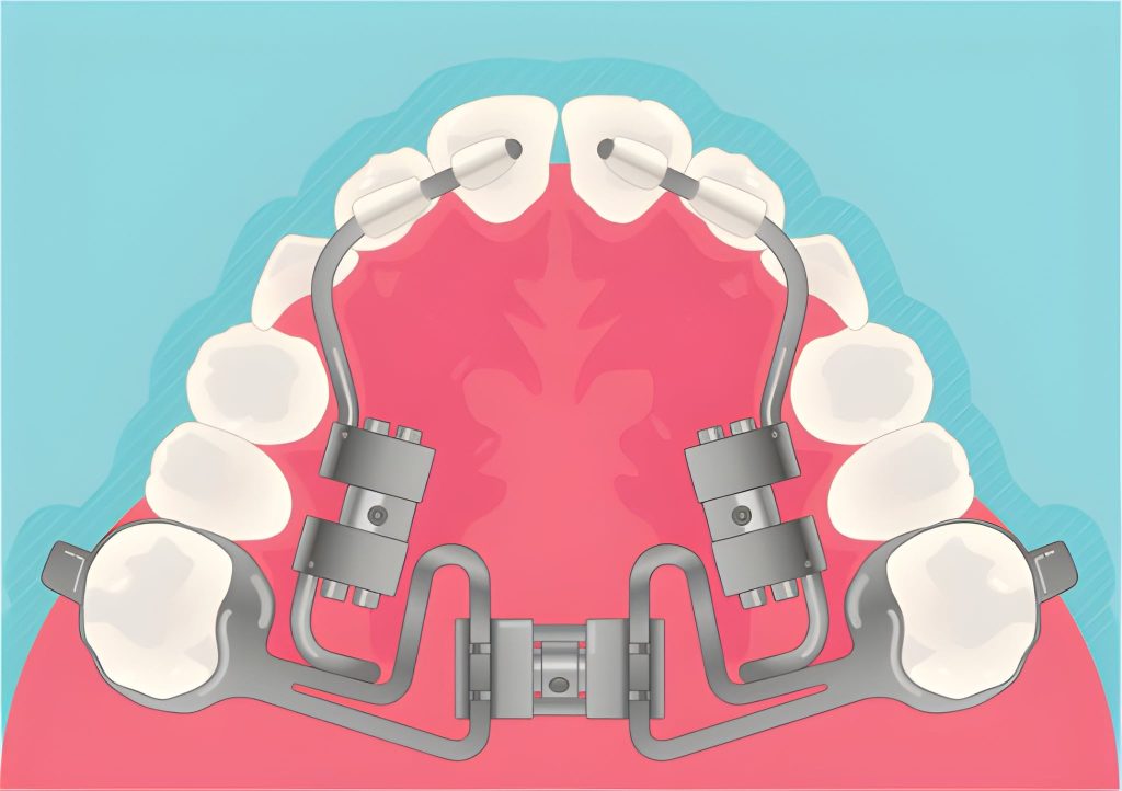 Connection Between Orthodontics