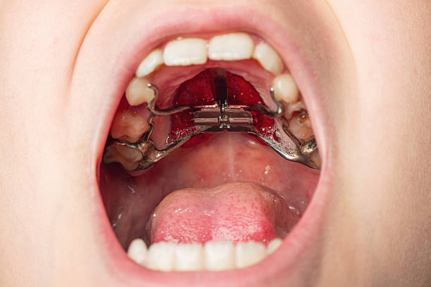 How Orthodontics Improves Jaw Function and Alignment Jaw Function and Alignment